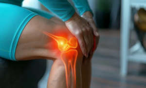 Gonarthrose